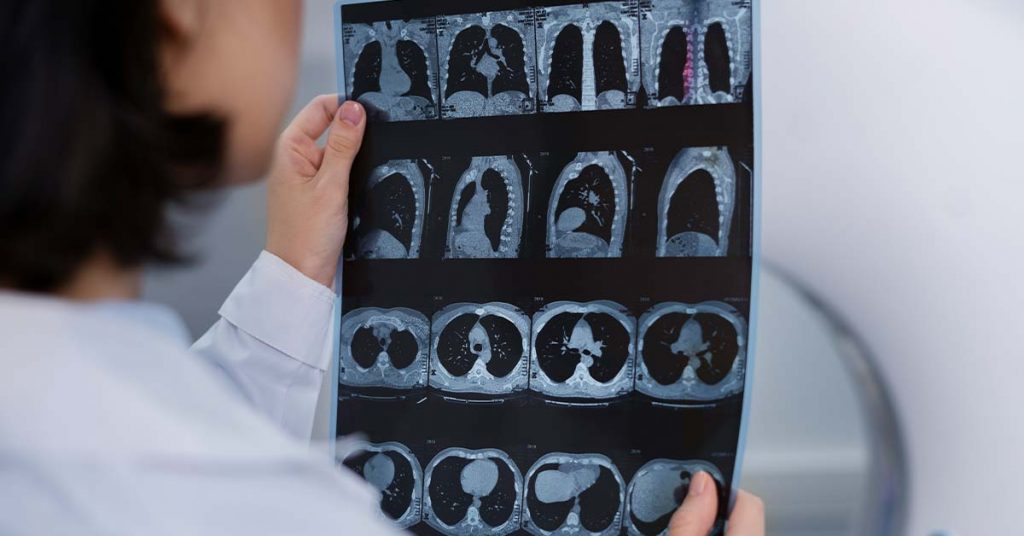 Descubra os Benefícios e o Funcionamento da Radioterapia